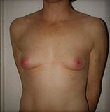 small breast example_closeup.jpg