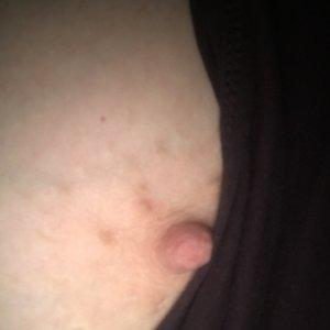 Pink Nips