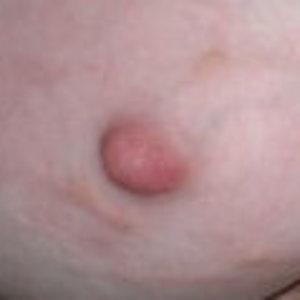 nipple.jpg