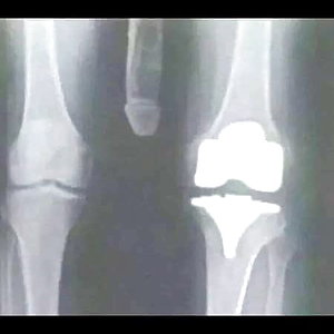 knee problems.jpg
