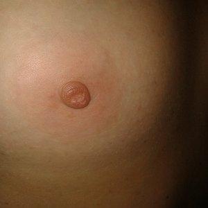 my nipple